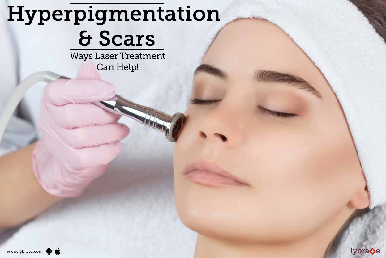 Hyperpigmentation & Scars Ways Laser Treatment Can Help! By Dr