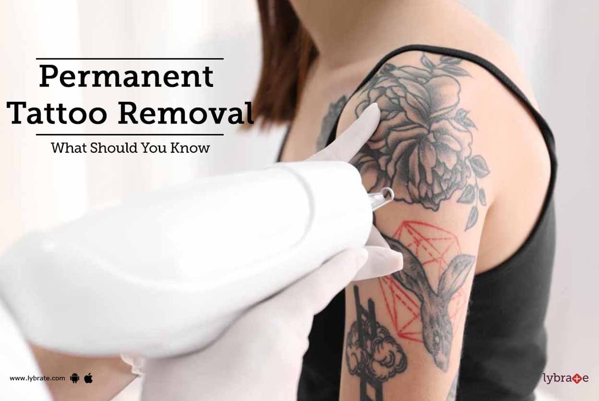 The Scoop on Tattoo Removal - Touch MedSpa