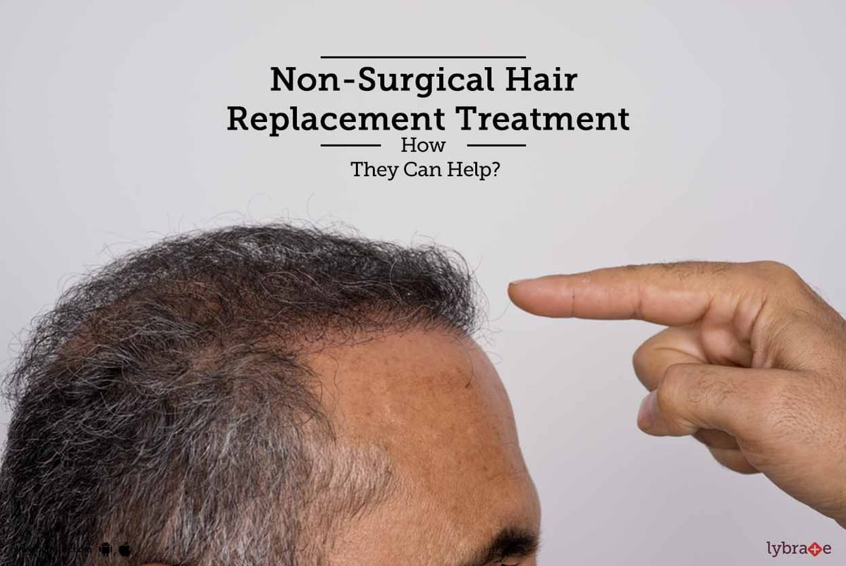 Non-Surgical Hair Replacement Treatment - How They Can Help? - By Dr. Nitin  Jain | Lybrate