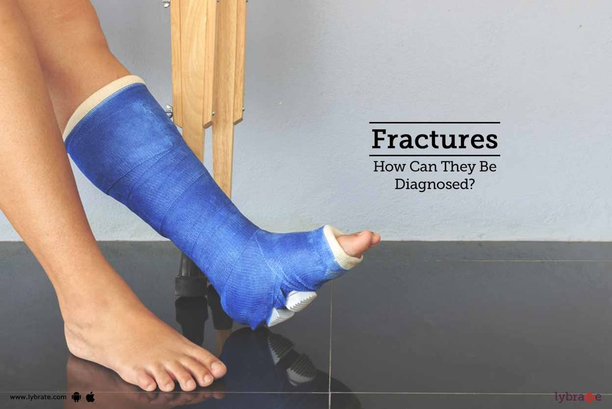 Fractures - How Can They Be Diagnosed? - By Dr. Chirag Chudasama | Lybrate