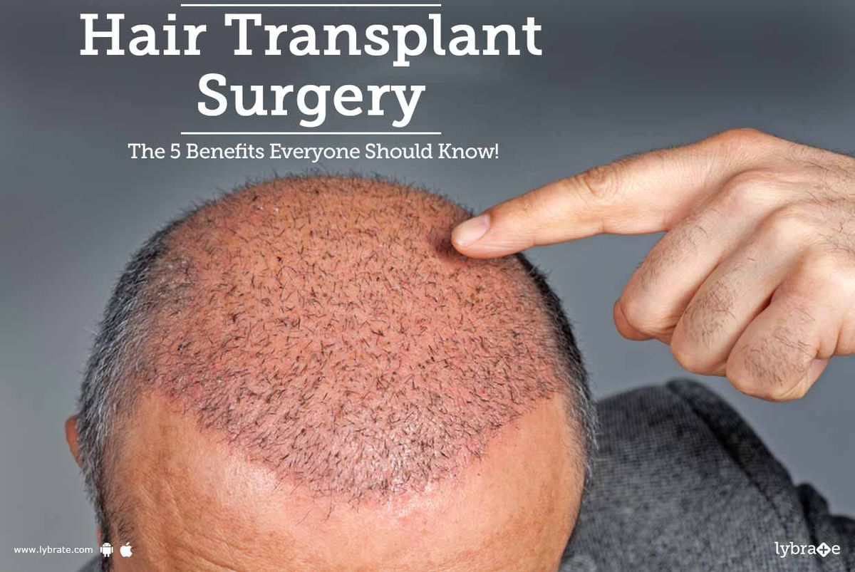 Hair Transplant Surgery- The 5 Benefits Everyone Should Know! - By Dr.  Shobha Jindal | Lybrate