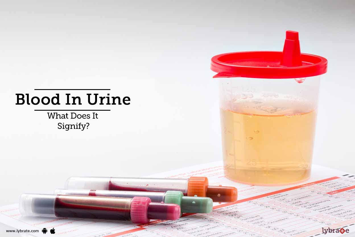 Blood In Urine What Does It Signify? By Dr. Nikhil Sharma Lybrate