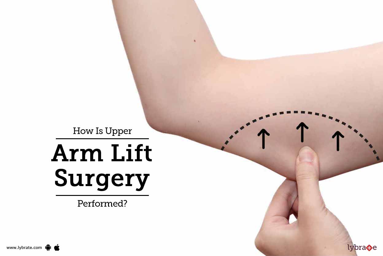 How Is Upper Arm Lift Surgery Performed? By Dr. Bheem S Nanda Lybrate