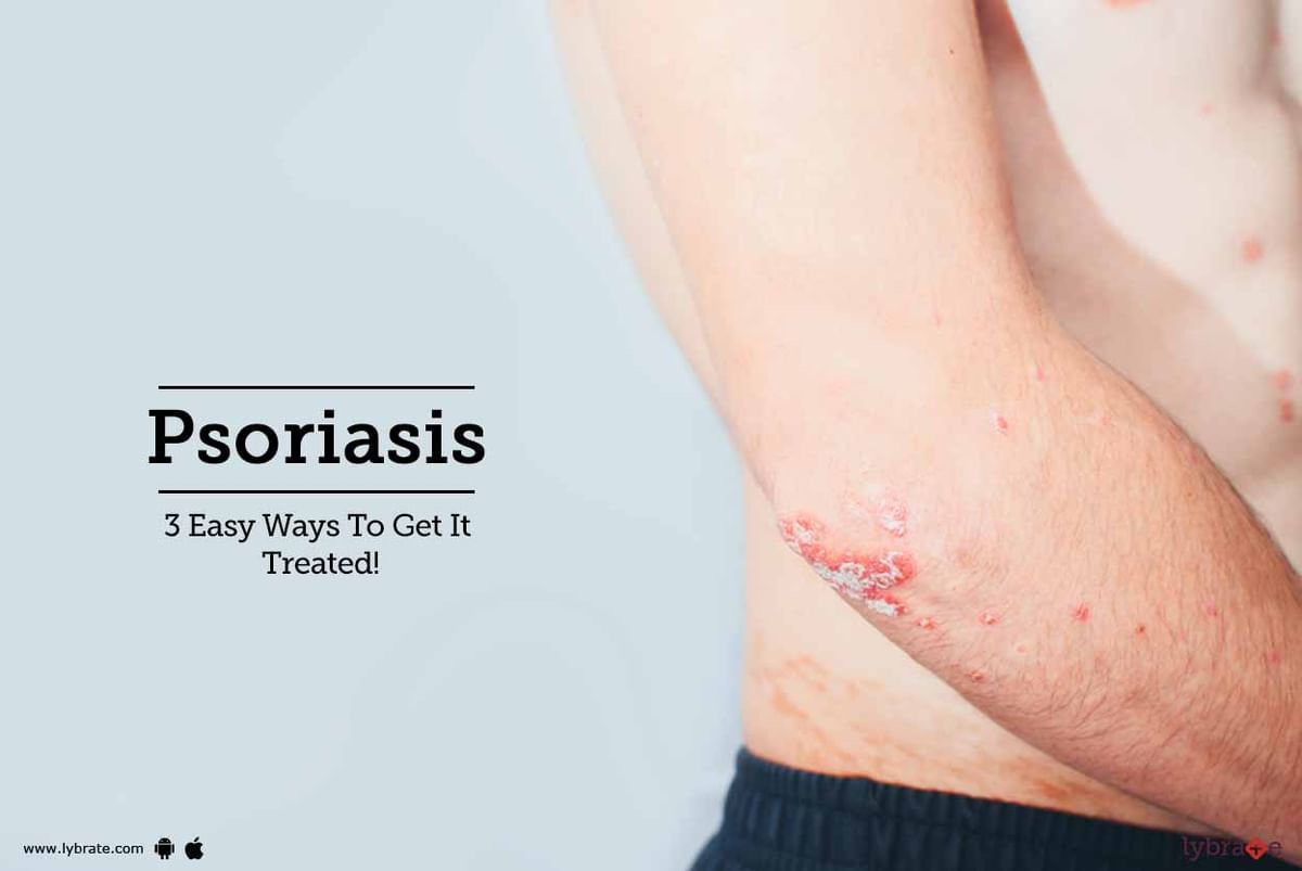 Psoriasis - 3 Easy Ways To Get It Treated! - By Gnh Excel Medical ...