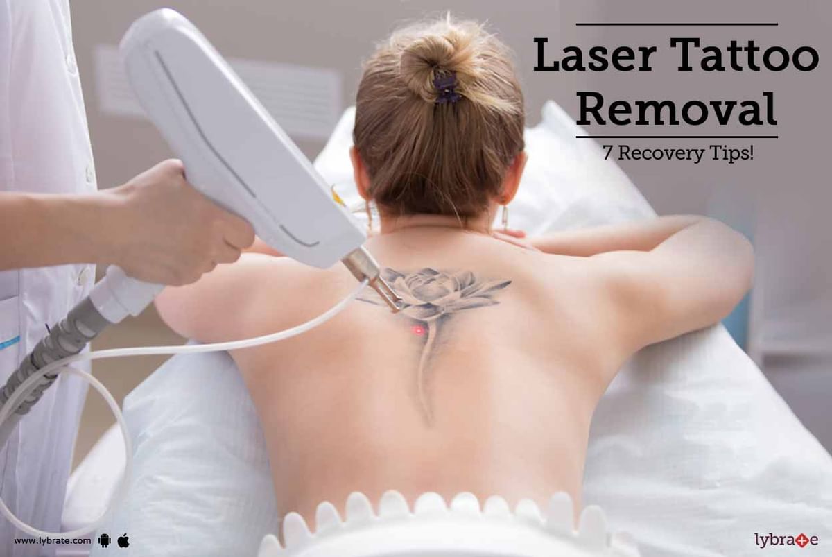 Can You Get a Tattoo Replacement After Laser Tattoo Removal