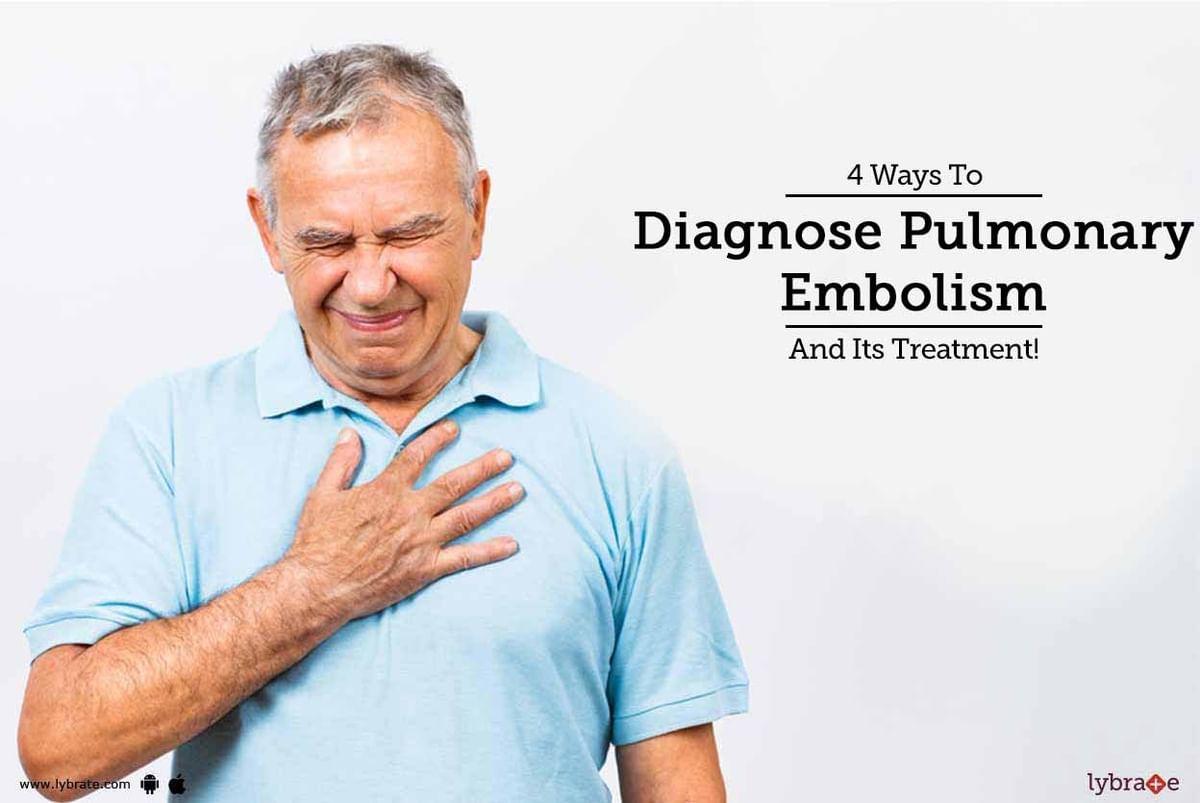 4 Ways To Diagnose Pulmonary Embolism And Its Treatment! - By Dr ...