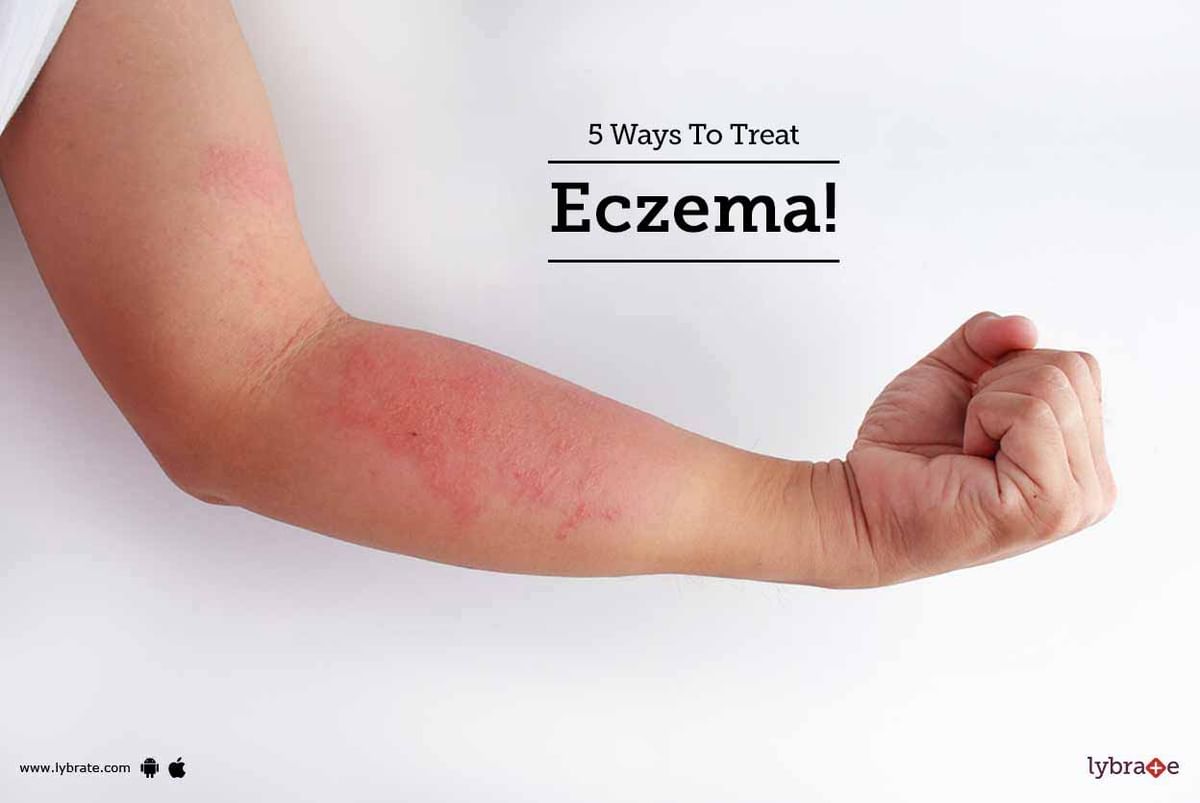 5 Ways To Treat Eczema! - By Dr. Sandesh Gupta | Lybrate