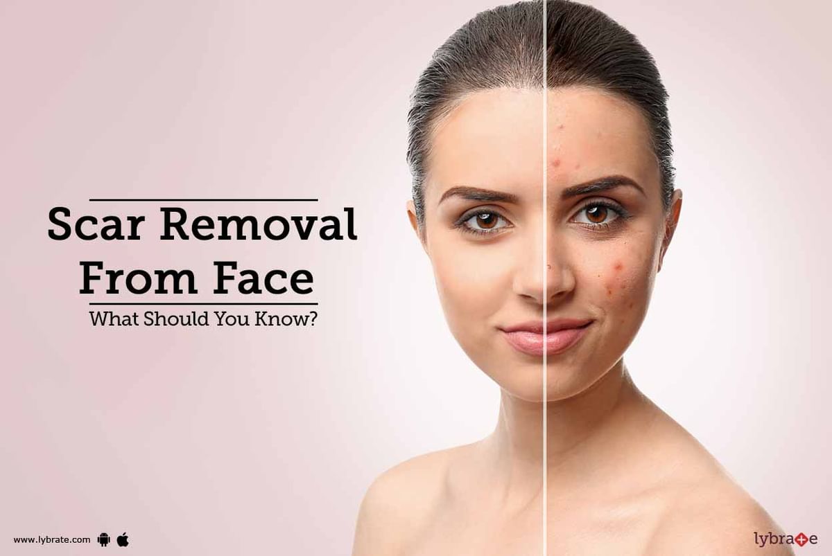 Scar Removal From Face - What Should You Know? - By Dr. Bheem S Nanda ...