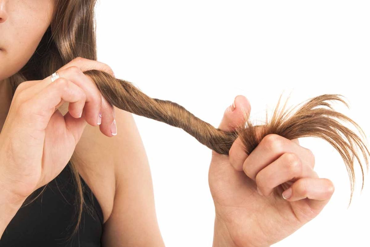 Hair Thinning - Treatments That Can Help Manage It! - By Hairline International | Lybrate Hair Thinning - Treatments That Can Help Manage It! - By Hairline International | Lybrate
