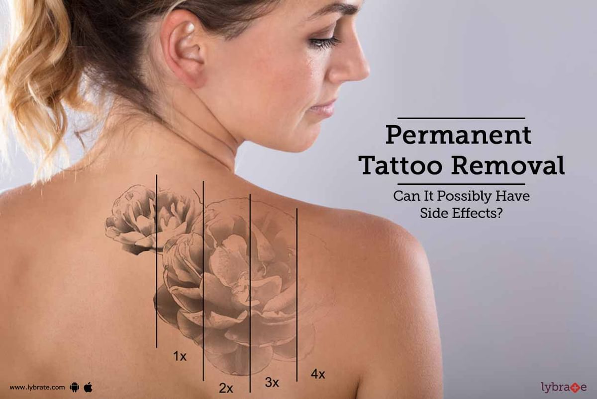 Permanent Tattoo Removal  Know Risks And Side Effects  By Dr Neeharika  Manchanda  Lybrate