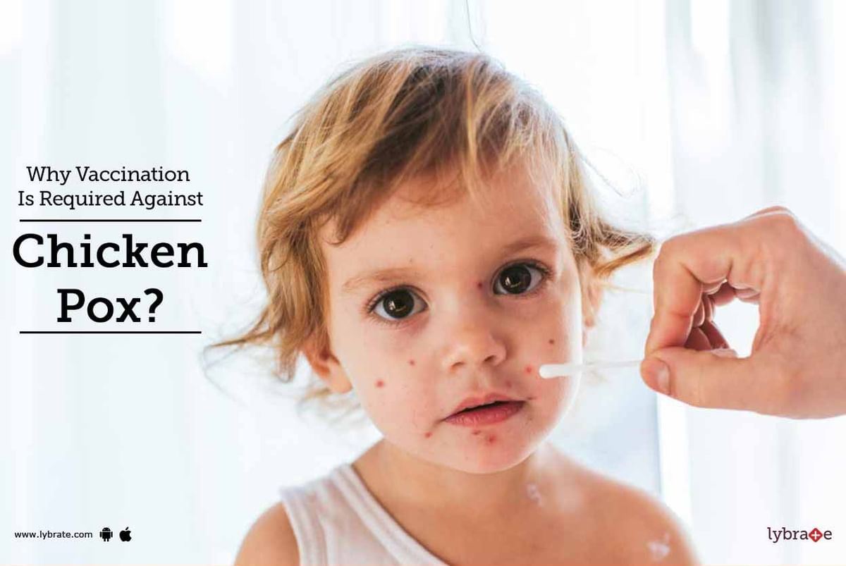 Why Vaccination Is Required Against Chicken Pox? - By Dr. Major Naveen 