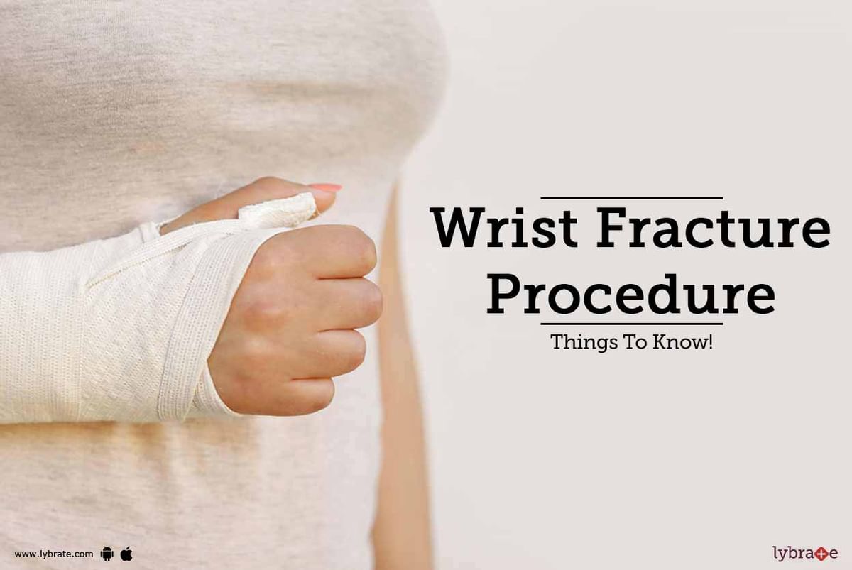 Wrist Fracture Procedure Things To Know By Dr Abhinav Bhatnagar Lybrate