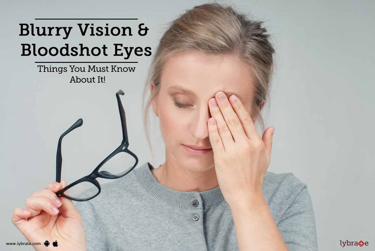 Blurry Vision & Bloodshot Eyes Things You Must Know About It! By Dr. Shashi Shekhar Lybrate