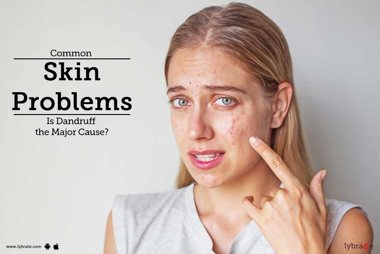 Common Skin Problems Is Dandruff the Major Cause? By Dr. Ashima