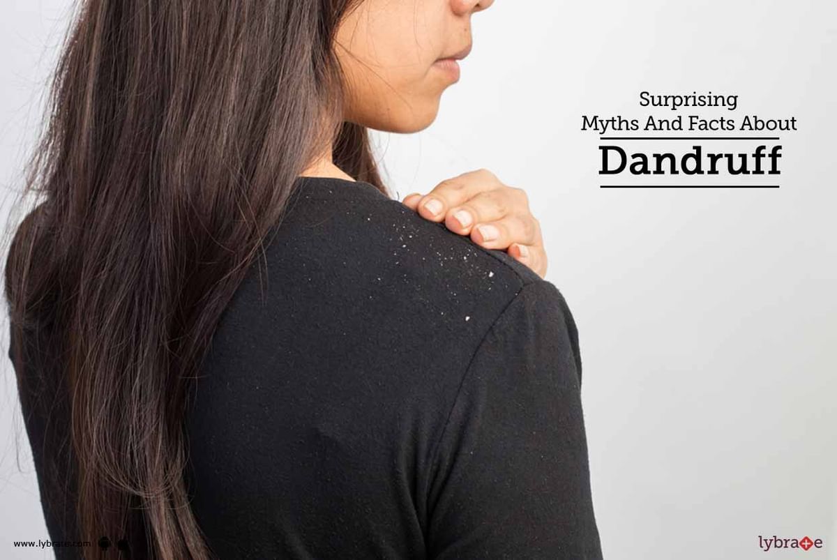 Surprising Myths And Facts About Dandruff - By Isaac - International Skin &  Anti Ageing Centre | Lybrate