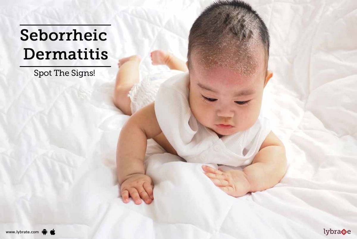 Seborrheic Dermatitis Spot The Signs By Dr Nitin Jain Lybrate