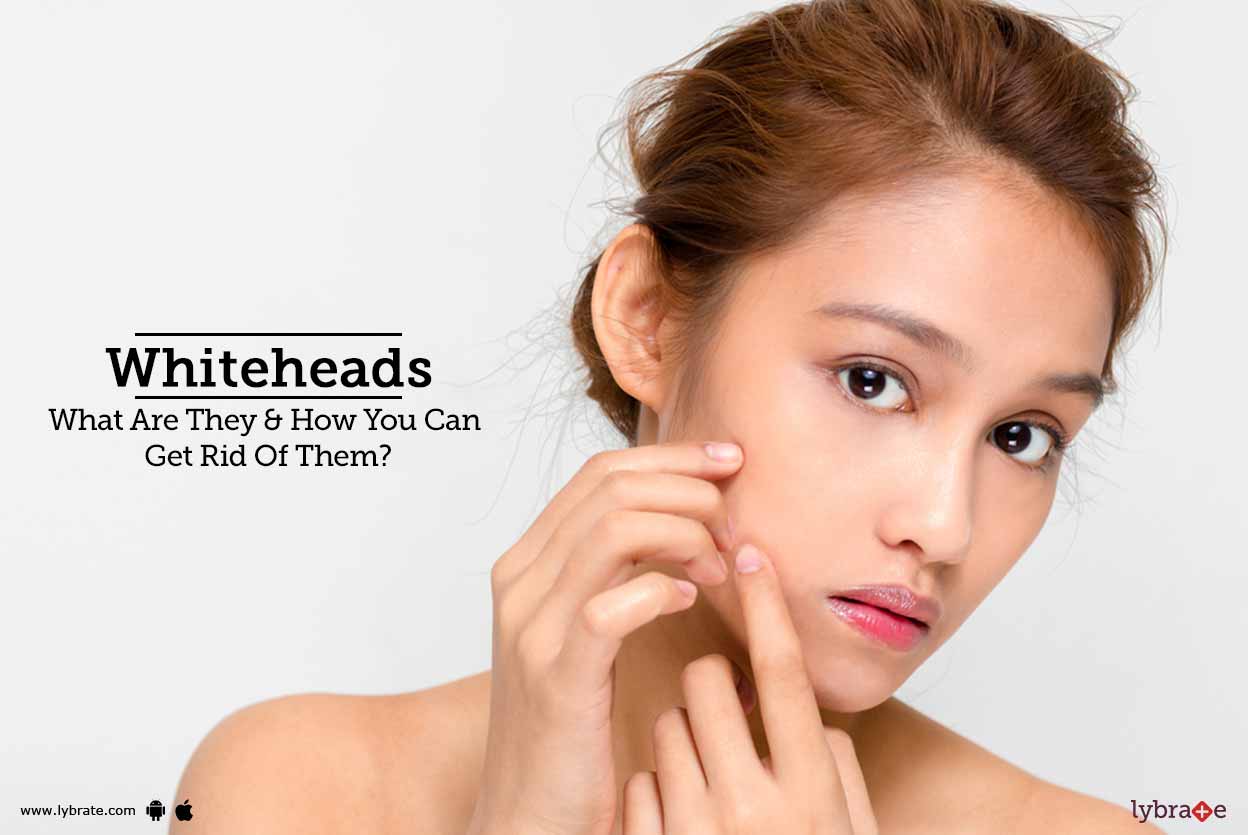 Whiteheads What Are They & How You Can Get Rid Of Them? By Dr