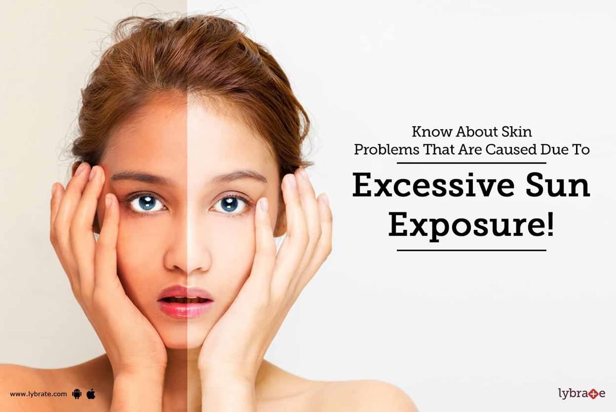 know-about-skin-problems-that-are-caused-due-to-excessive-sun-exposure