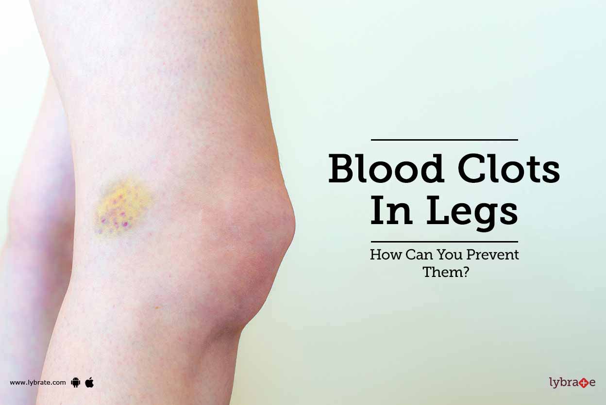 Blood Clots In Legs How Can You Prevent Them? By Dr. Shantanu Jain Lybrate