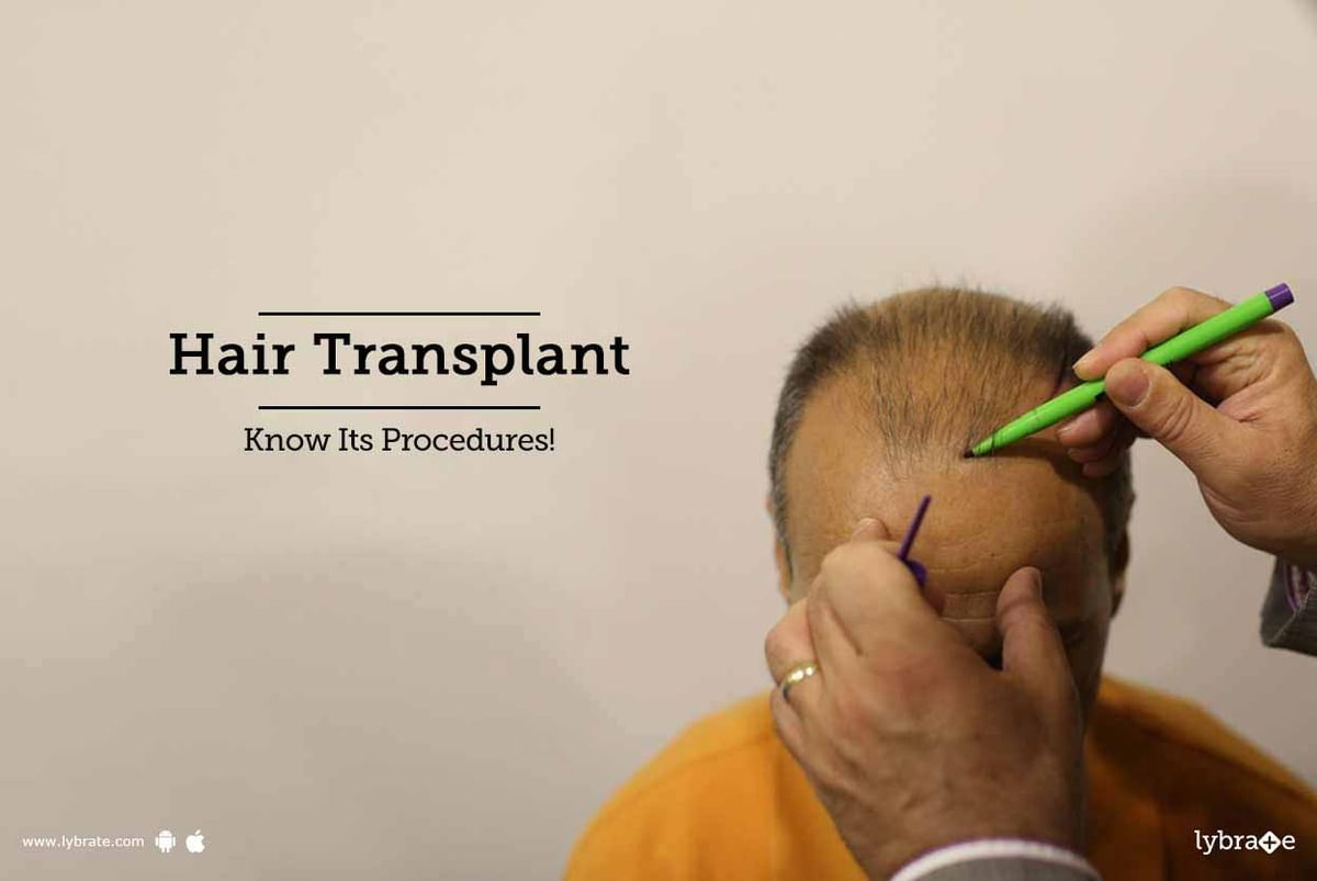 Hair Transplant - Know Its Procedures! - By Dr. Jayanta Bain | Lybrate