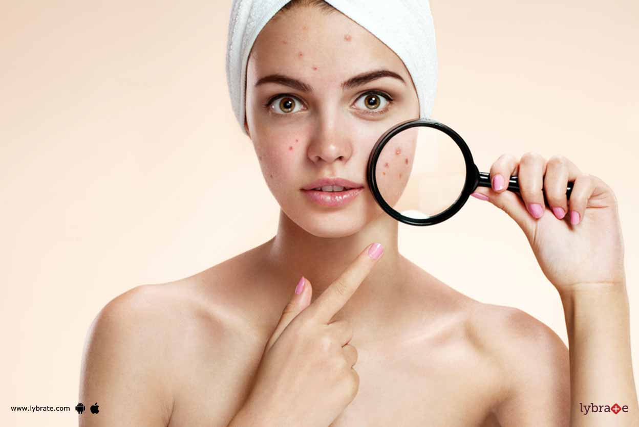 Acne Ayurvedic Ways Of Treating It! By Dr. Jiva Ayurveda Lybrate