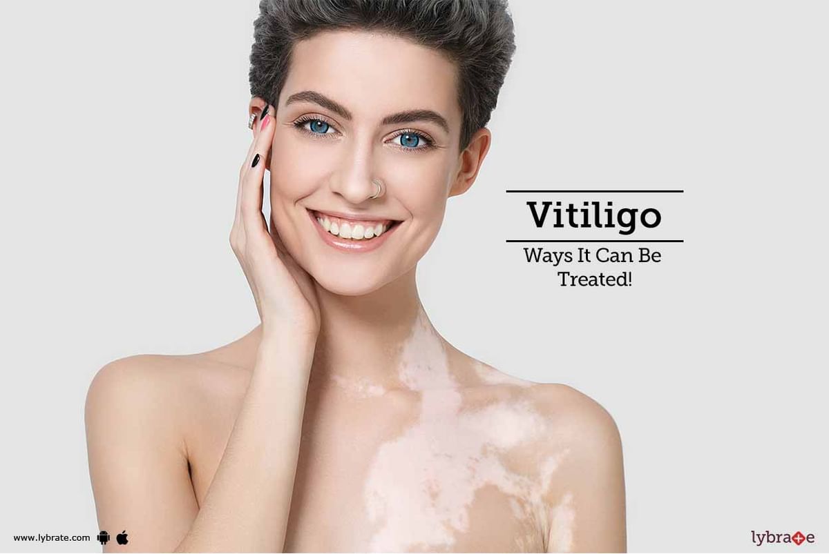 Best Vitiligo Treatment Medical & Surgical Methods By Paul's