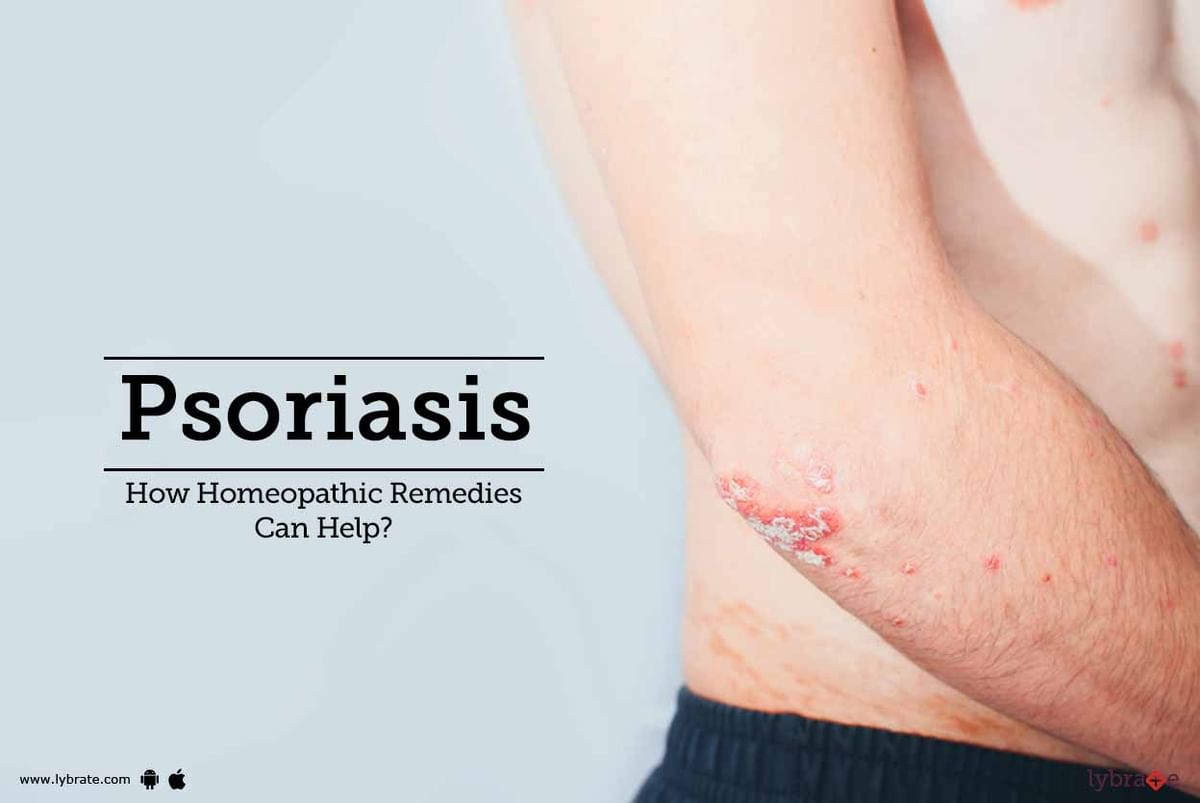 Psoriasis - How Homeopathic Remedies Can Help? - By Dr. Anju Vohra ...