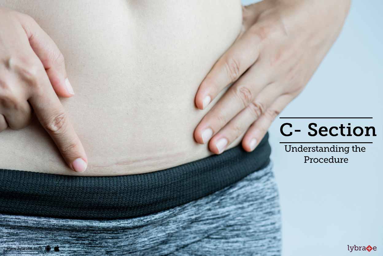 C- Section - Understanding The Procedure - By Dr. Parul Aggarwal | Lybrate