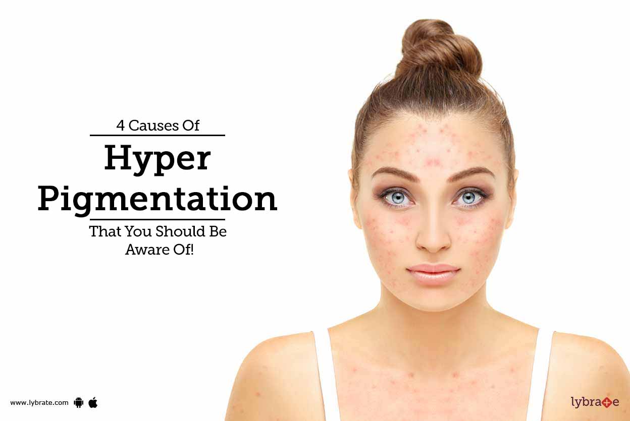 4 Causes Of Hyper Pigmentation That You Should Be Aware Of! By Dr