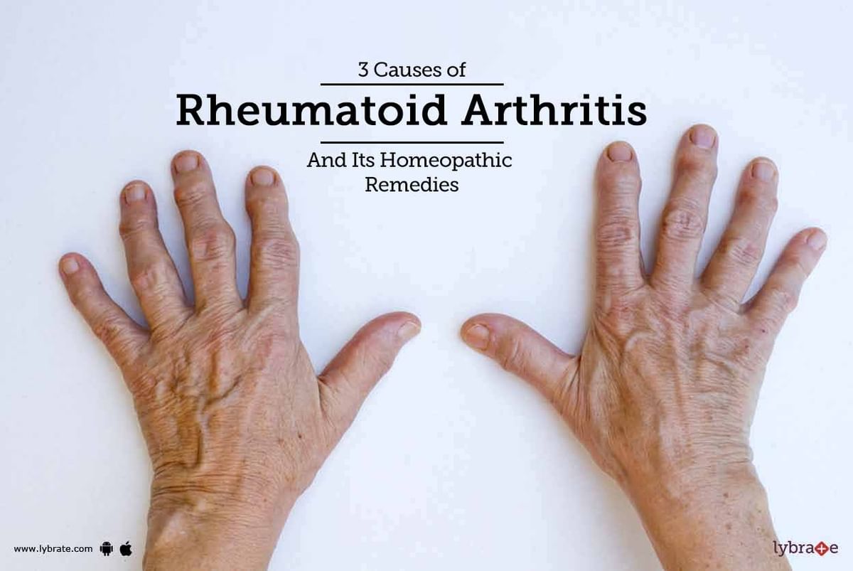 3 Causes Of Rheumatoid Arthritis And Its Homeopathic Remedies - By Dr 