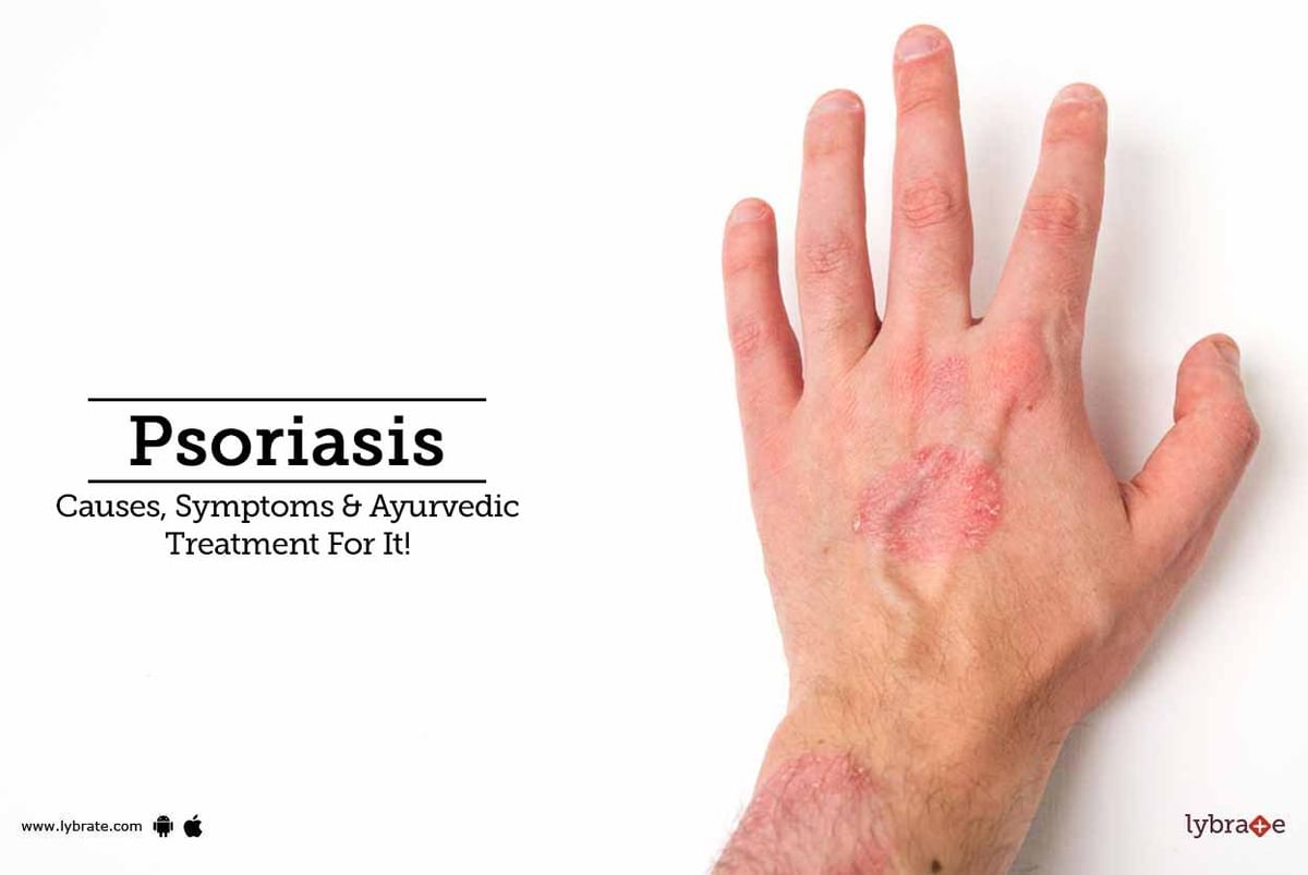 Psoriasis Causes Symptoms And Ayurvedic Treatment For It By Bnchy Wellness Medispa Lybrate