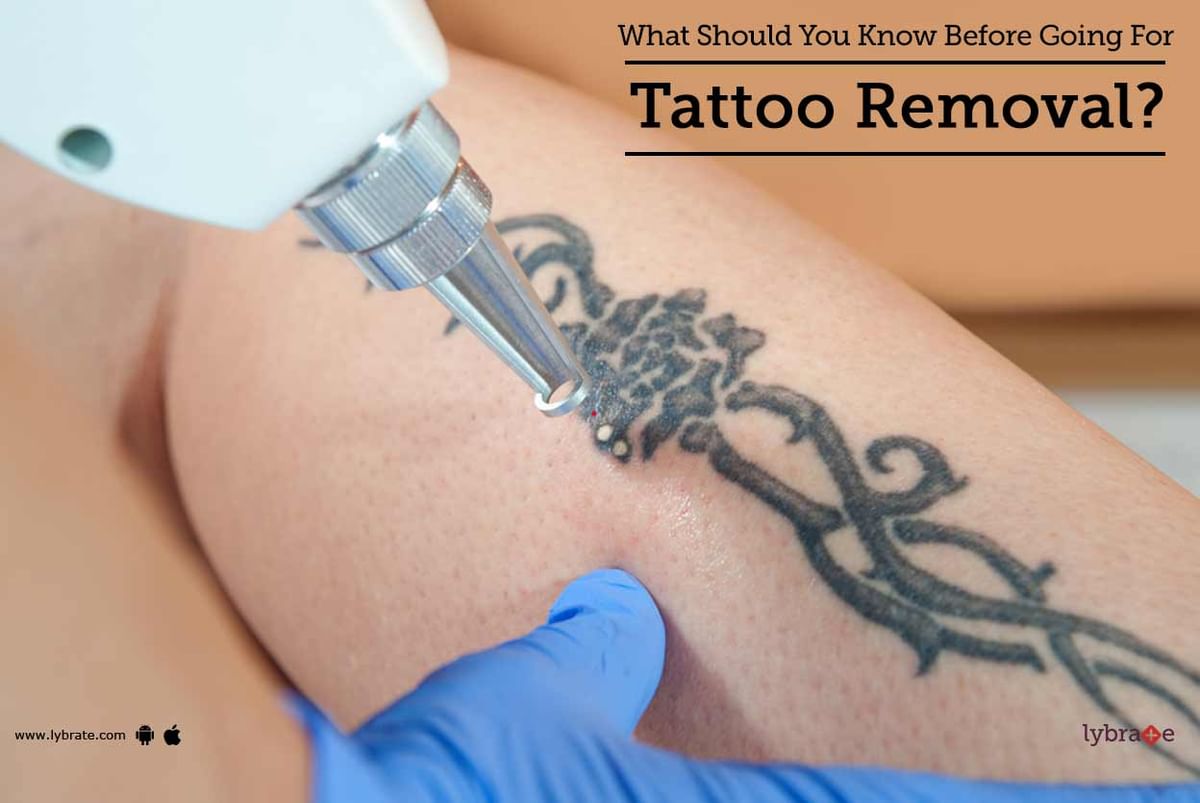What Should You Know Before Going For Tattoo Removal? - By Kaya Skin Clinic  | Lybrate