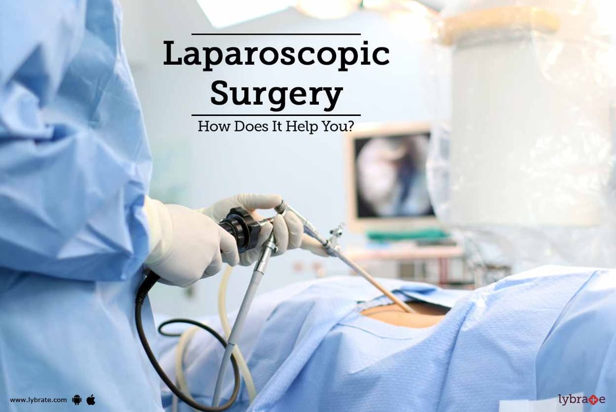 Laparoscopic Surgery - How Does It Help You? - By Dr. Manju Aggarwal ...