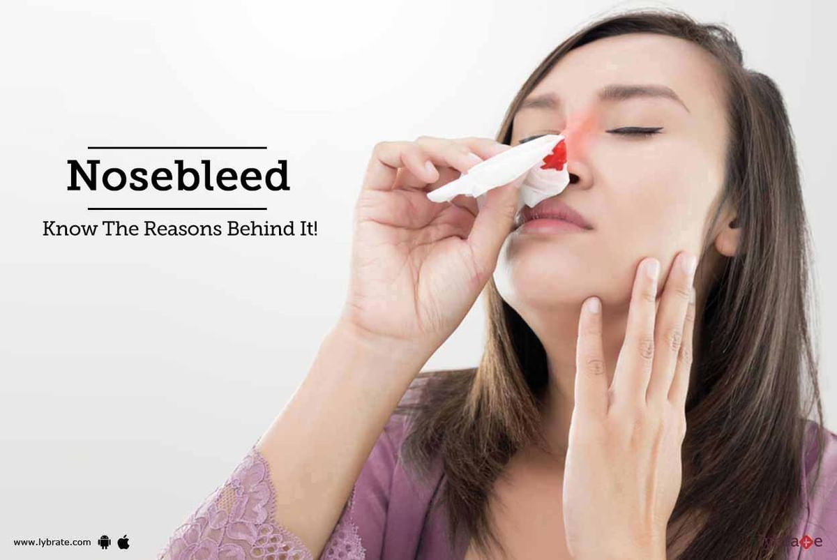 Nosebleed - Know The Reasons Behind It! - By Dr. Akriba Ahmed | Lybrate