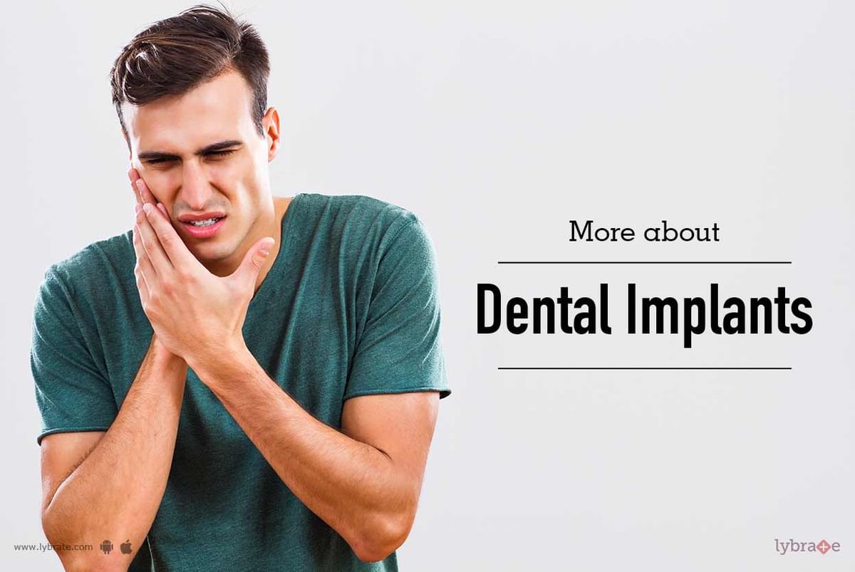 More About Dental Implants - By Dr. Vaibhav Garg | Lybrate