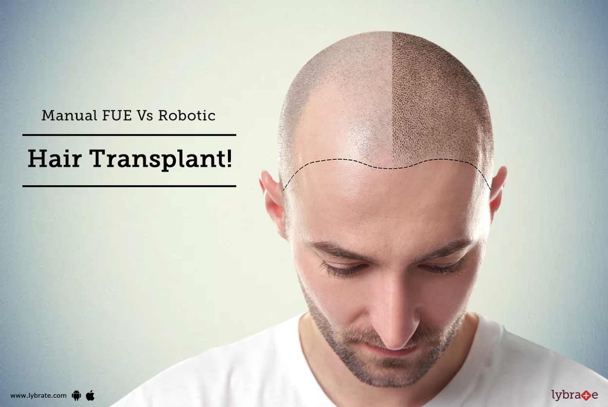 Manual FUE Vs Robotic Hair Transplant! - By Hairline International | Lybrate