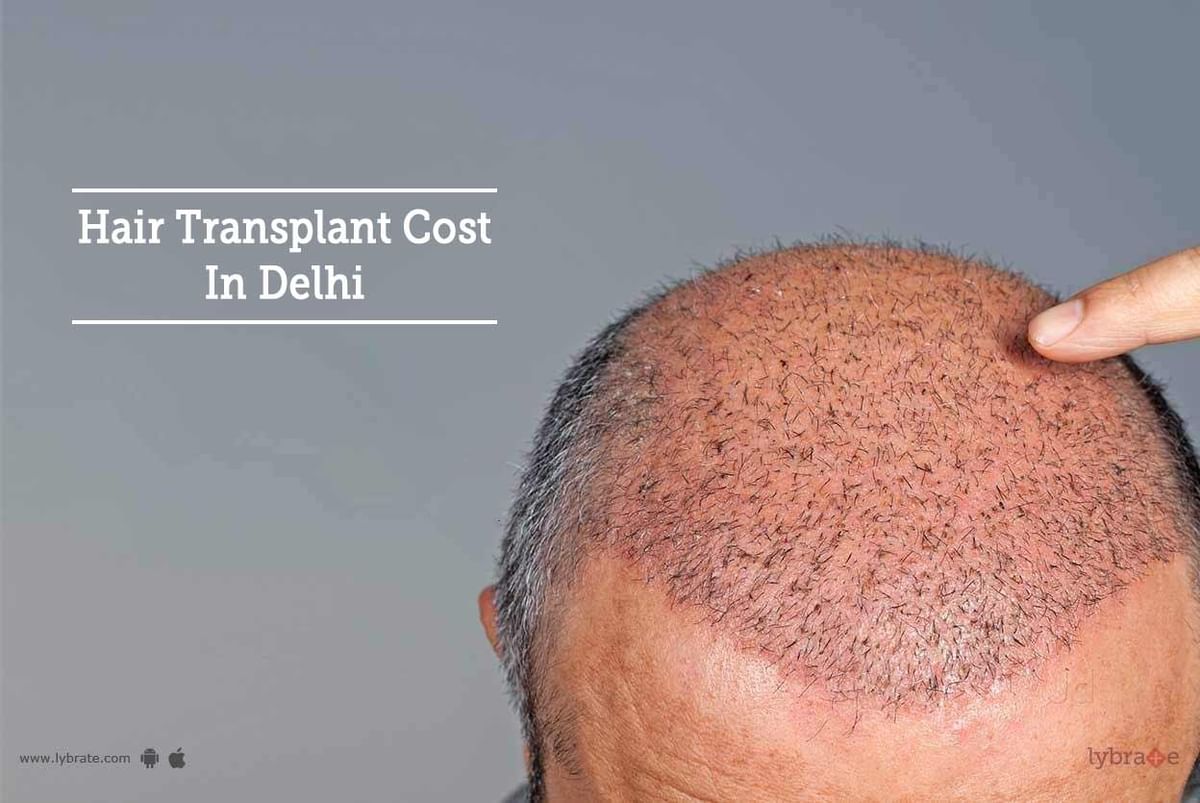 Hair Transplant Cost In Delhi - By Dr. Sanjeev Kumar Singh | Lybrate