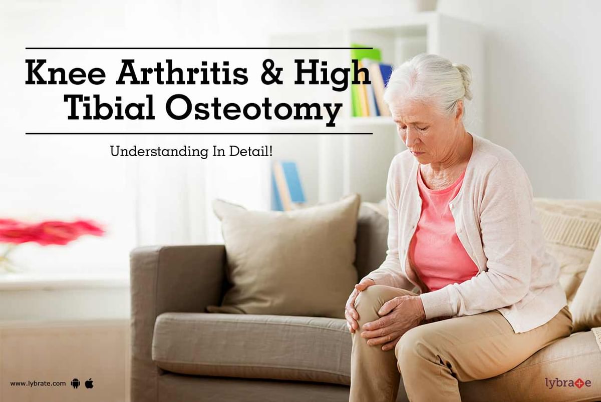 Knee Arthritis & High Tibial Osteotomy - Understanding It In Detail ...