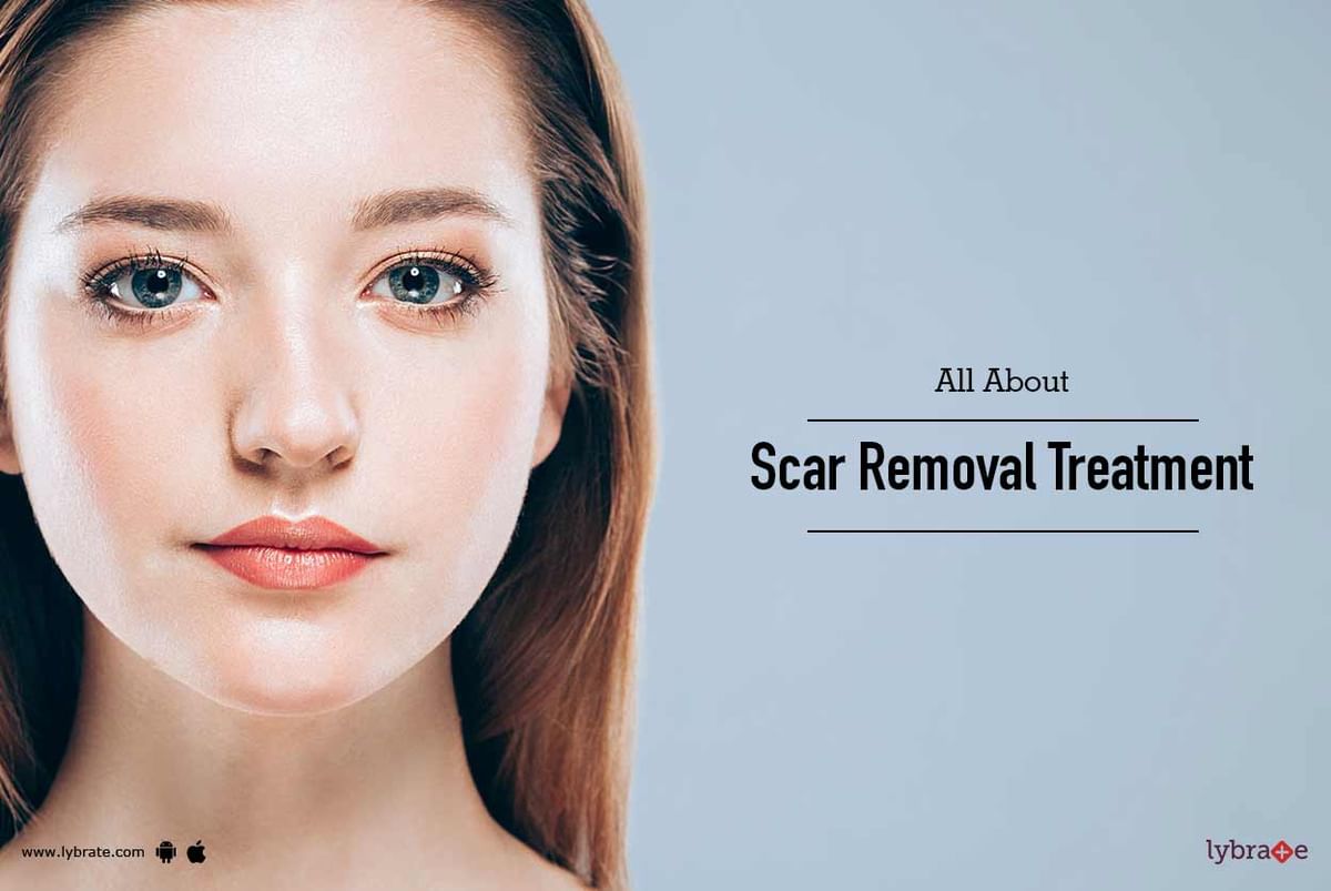 All About Scar Removal Treatment By Dr Amit Varma Lybrate 3955