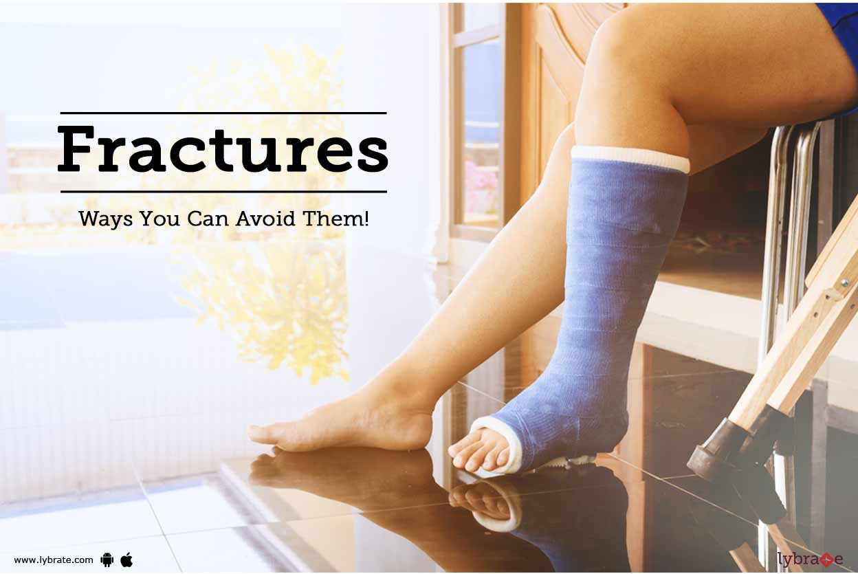 Fractures Ways You Can Avoid Them! By Dr. Vivek A N Lybrate