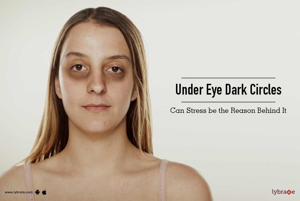How To Remove Dark Circles Under Eyes   SkinKraft