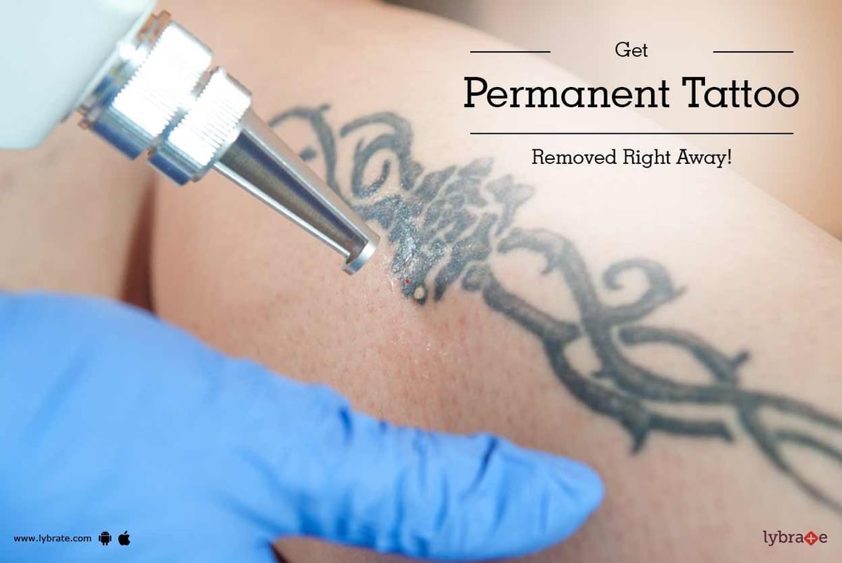 Get Permanent Tattoo Removed Right Away! - By Dr. Shruti Kohli | Lybrate