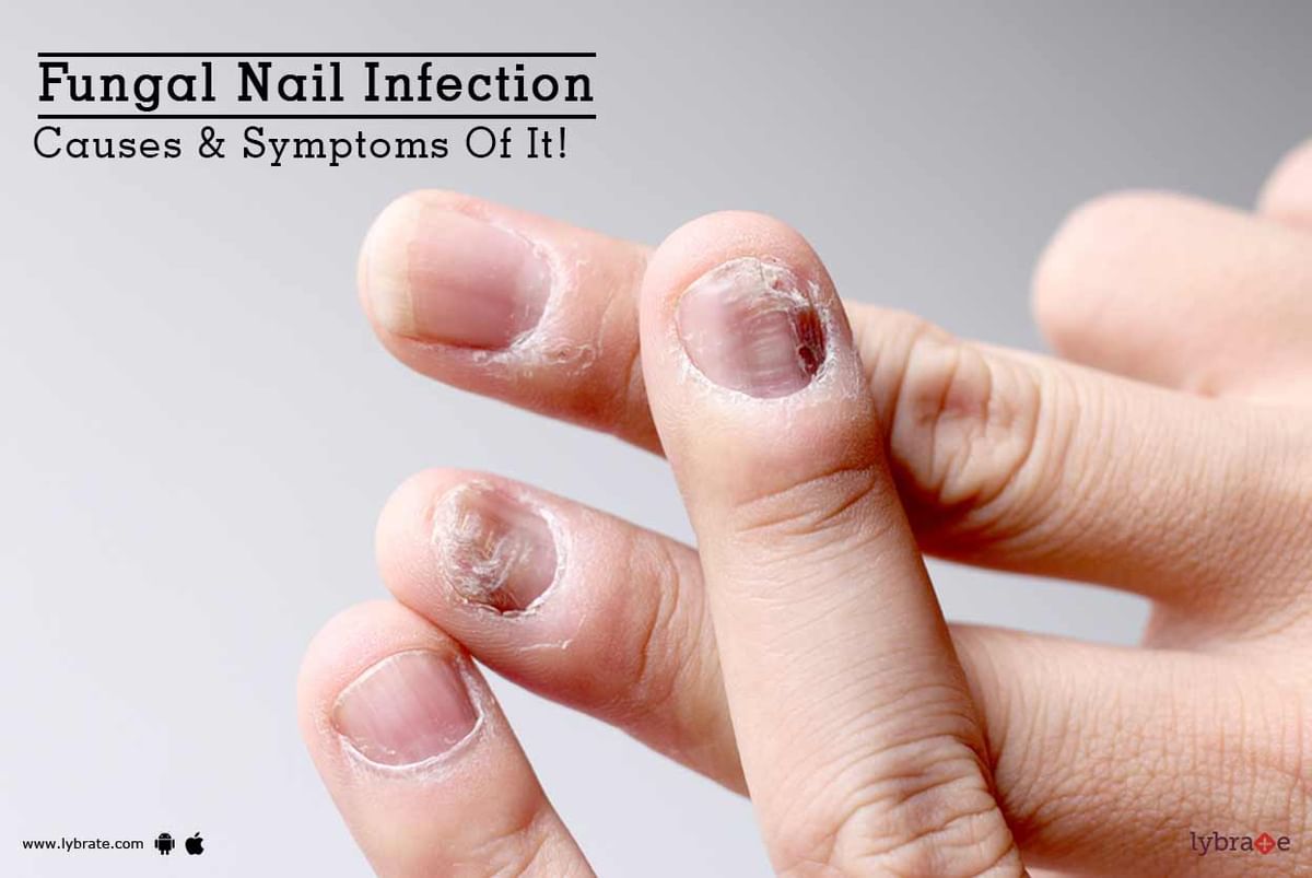 Why Is Toenail Fungus So Difficult to Treat? | University Hospitals