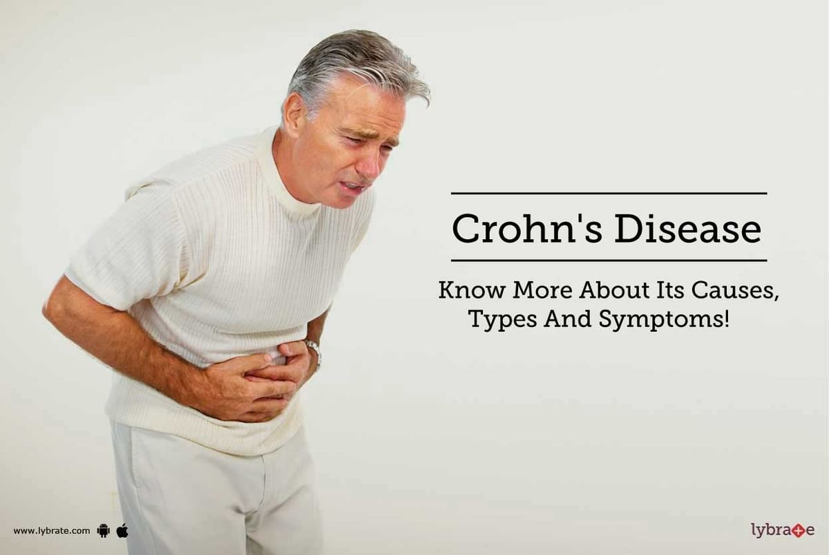 Crohn's Disease - Know More About Its Causes, Types And Symptoms! - By ...