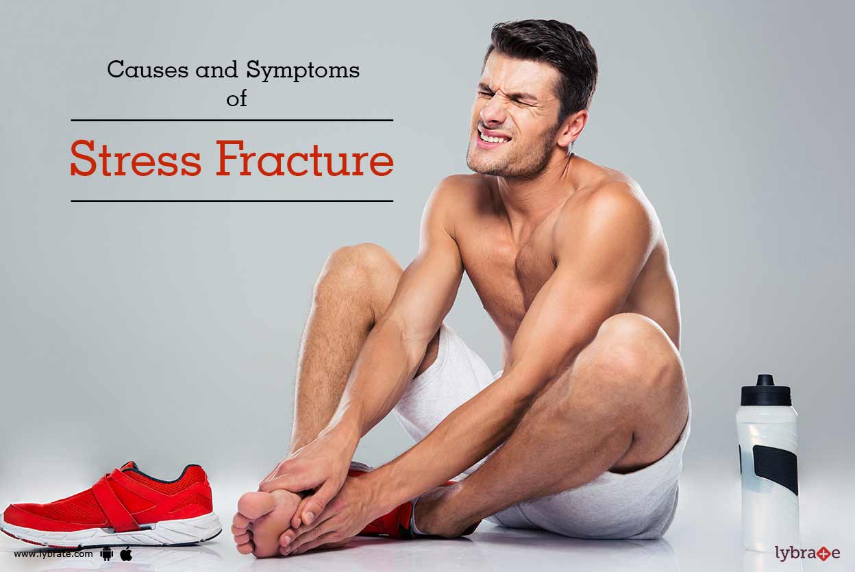 Causes and Symptoms of Stress Fracture By Dr. Abhishek Kumar Mishra