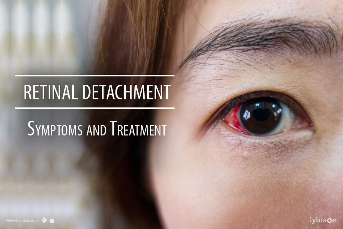 What is a Detached Retina?  Symptoms, Causes and Treatment