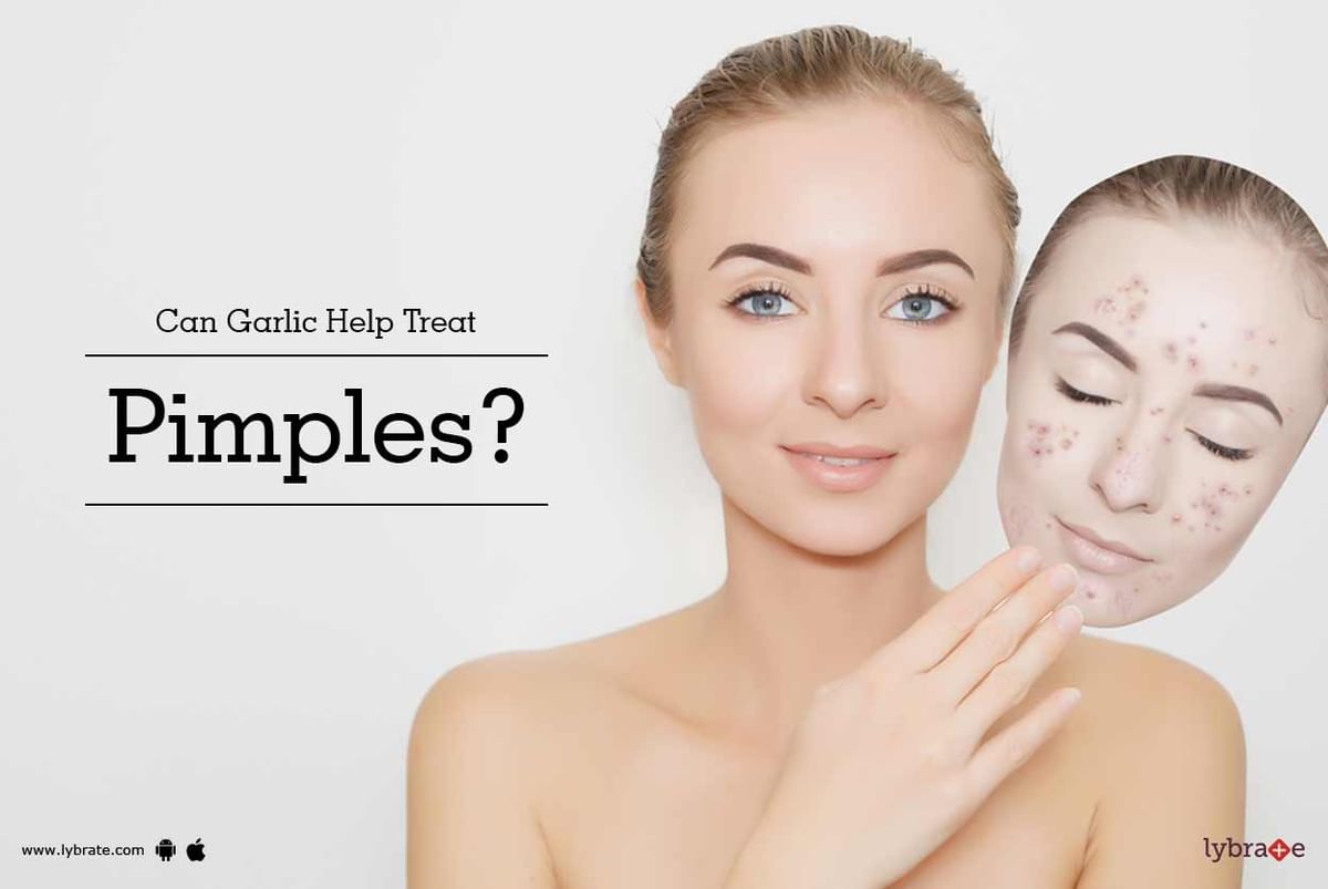 Can Garlic Help Treat Pimples? - By Dr. Pankaj Verma 