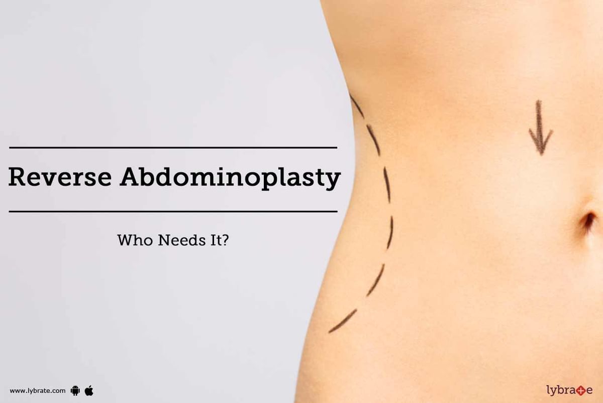 Reverse Abdominoplasty: Who Needs It? - By Dr. Vijaya