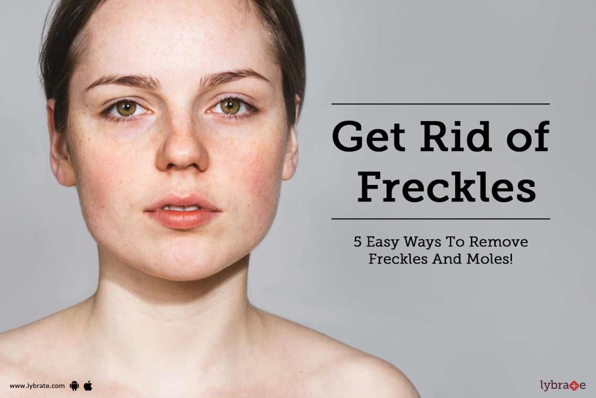 Get Rid Of Freckles 5 Easy Ways To Remove Freckles And Moles By Dr Deepak Kothari Lybrate 7037