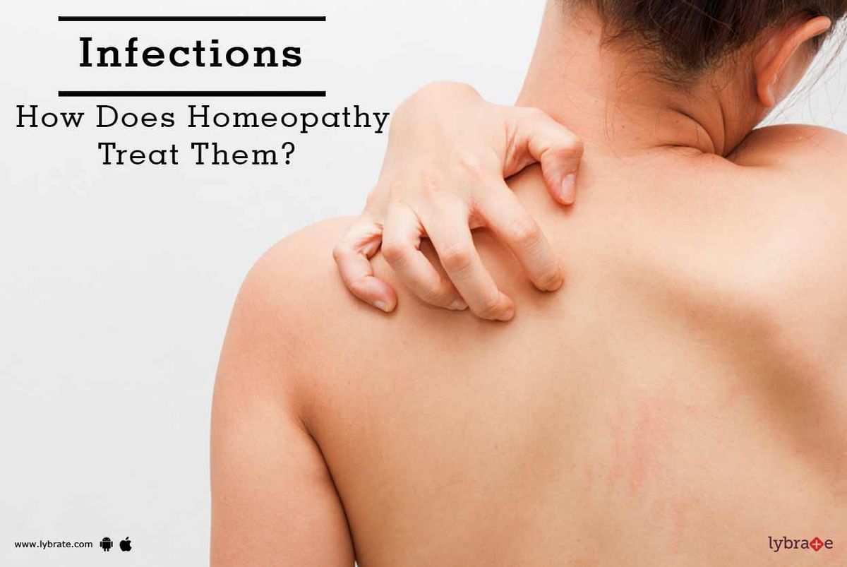 Infections How Does Homeopathy Treat Them By Dr Jyoti Singh Lybrate 2575